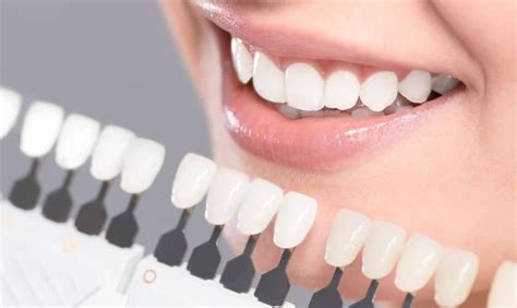 Whiten with Ease: The Magic of Teeth Whitening